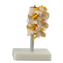 Model bederní páteře (tři obratle)