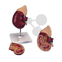 Ledvina s nadledvinkou (2 části)